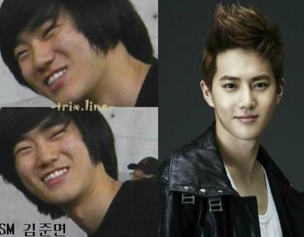 EXO团SUHO，有没有对SM公司找的整容医师很佩服？