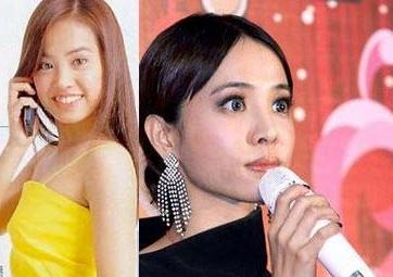 张雨绮，杨幂，王蓉，明星，整容