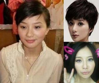 张雨绮，杨幂，王蓉，明星，整容