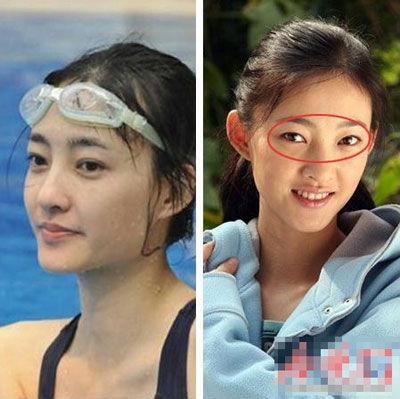 王丽坤旧照曝光疑整容