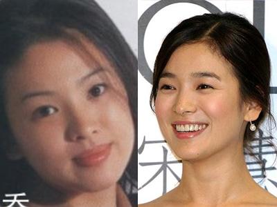 10位当红女星整容前后大曝光