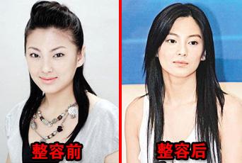 10位当红女星整容前后大曝光