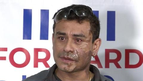 acid-attack-victim.jpg